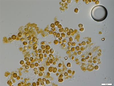 Symbiodinium_kawagutii.jpg