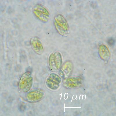 Unknown_unicellular_algae_DSC0043.jpg