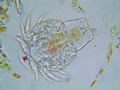 Copepod_nauplius-0010.jpg