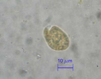 Amphidinium_cartherae_0029.jpg