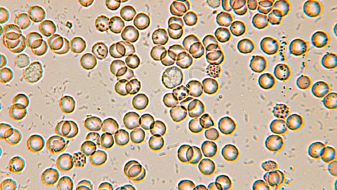 Эритроциты фото под микроскопом