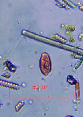 Katodinium_oxirrhys_60x-0013.jpg