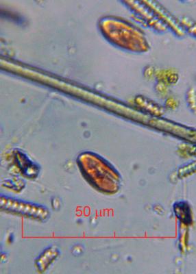 Katodinium_oxirrhys_60x-0001.jpg